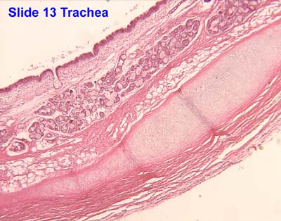 Cartilage diagram of duodenum 